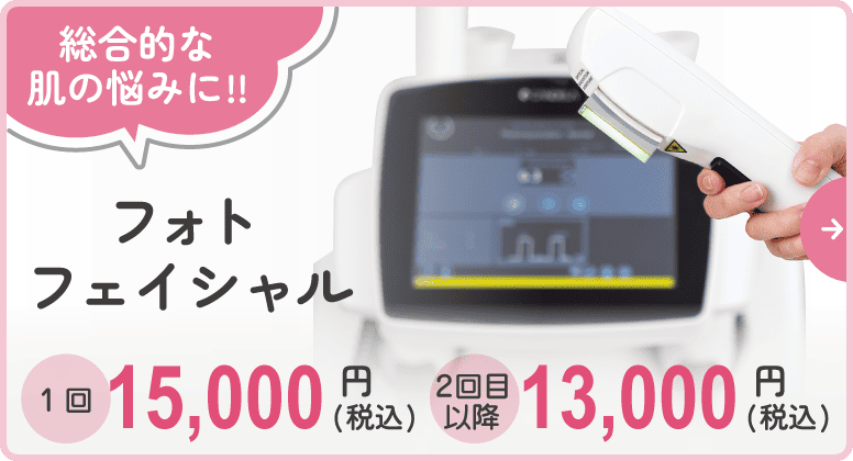 総合的な肌の悩みに!!フォトフェイシャル